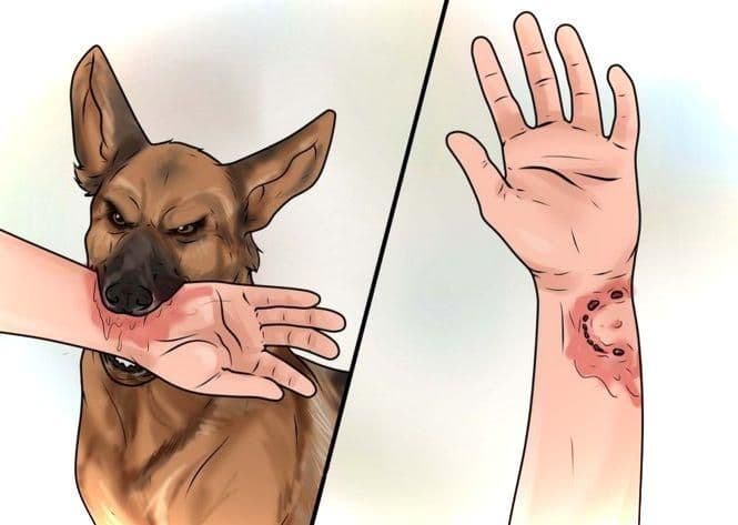 Симптомы после укуса собаки